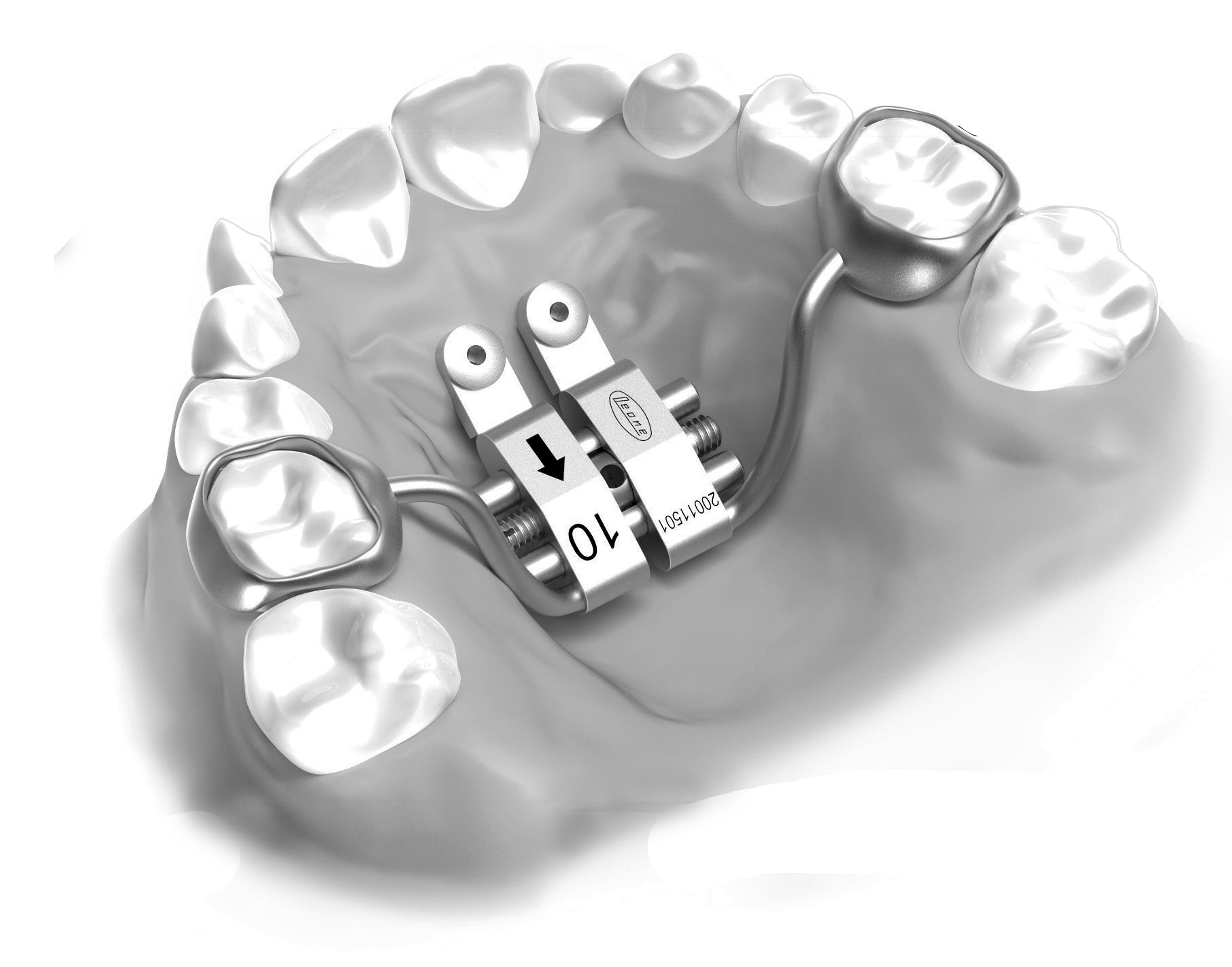 A201-620: CAD-CAM RPE Temporary Anchorage Device (TAD)